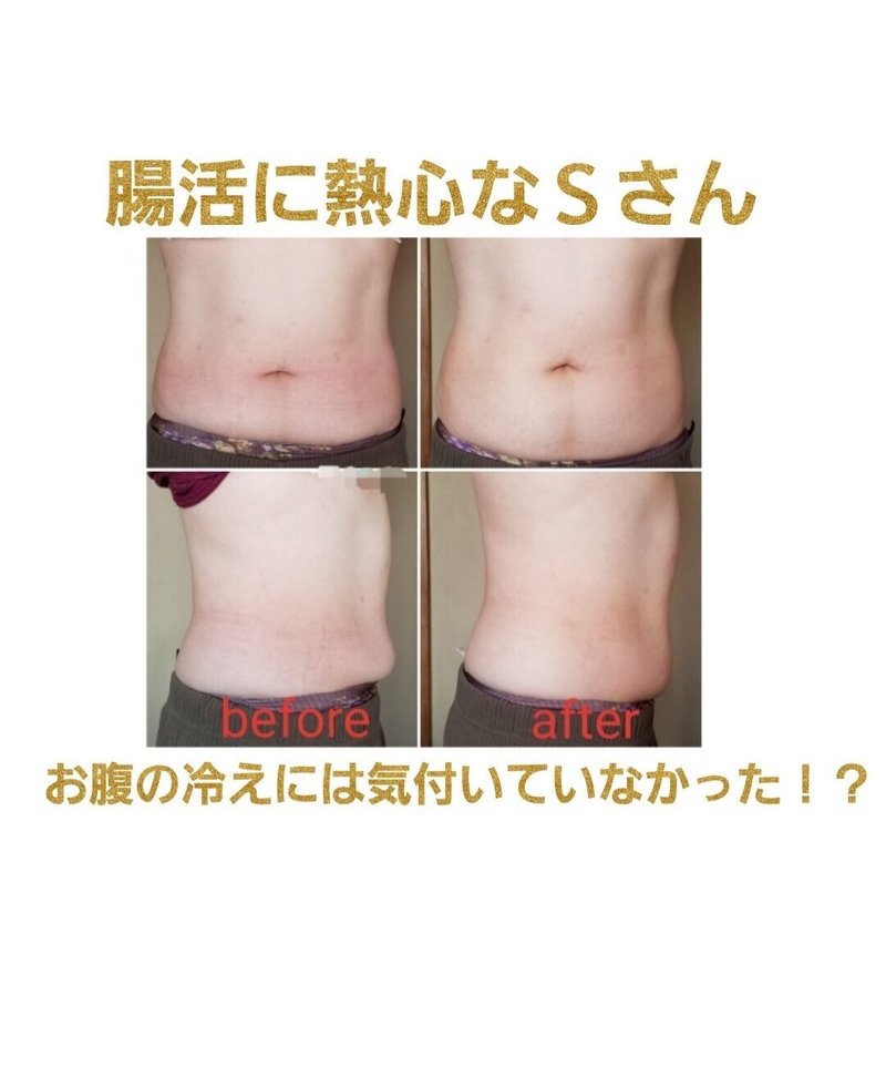 お腹が張るし硬い自覚はあるのに 冷えの自覚が全くない おなか美人コンシェルジュ田中道子 本気で変わりたい貴女の腸もメンタルもサポート Note お腹が張るし硬い自覚はあるのに 冷えの自覚が全くない おなか美人コンシェルジュ田中道子 本気で変わりたい貴女の腸もメンタルもサポート Note