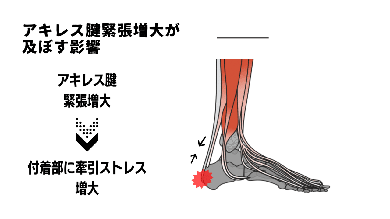 アキレス腱の痛みを慢性化させない理学療法とは サッカー選手 向けフィジカルサポートnote 石橋 哲平 Note
