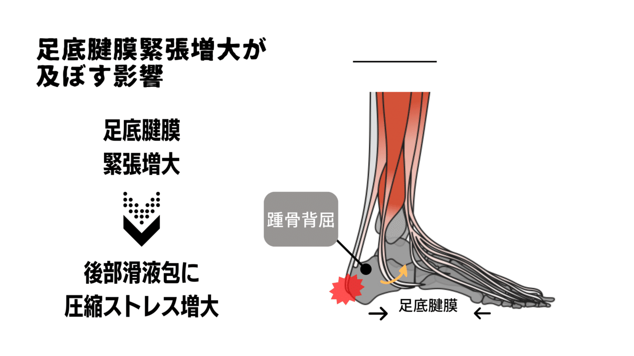アキレス腱の痛みを慢性化させない理学療法とは サッカー選手 向けフィジカルサポートnote 石橋 哲平 Note