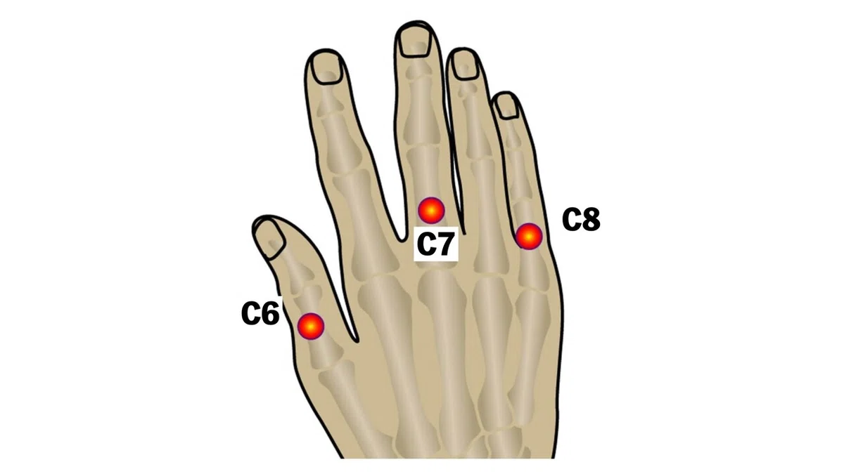 [4-Minute Explanation: Cervical Spondylosis] PT/OT National Exam ...