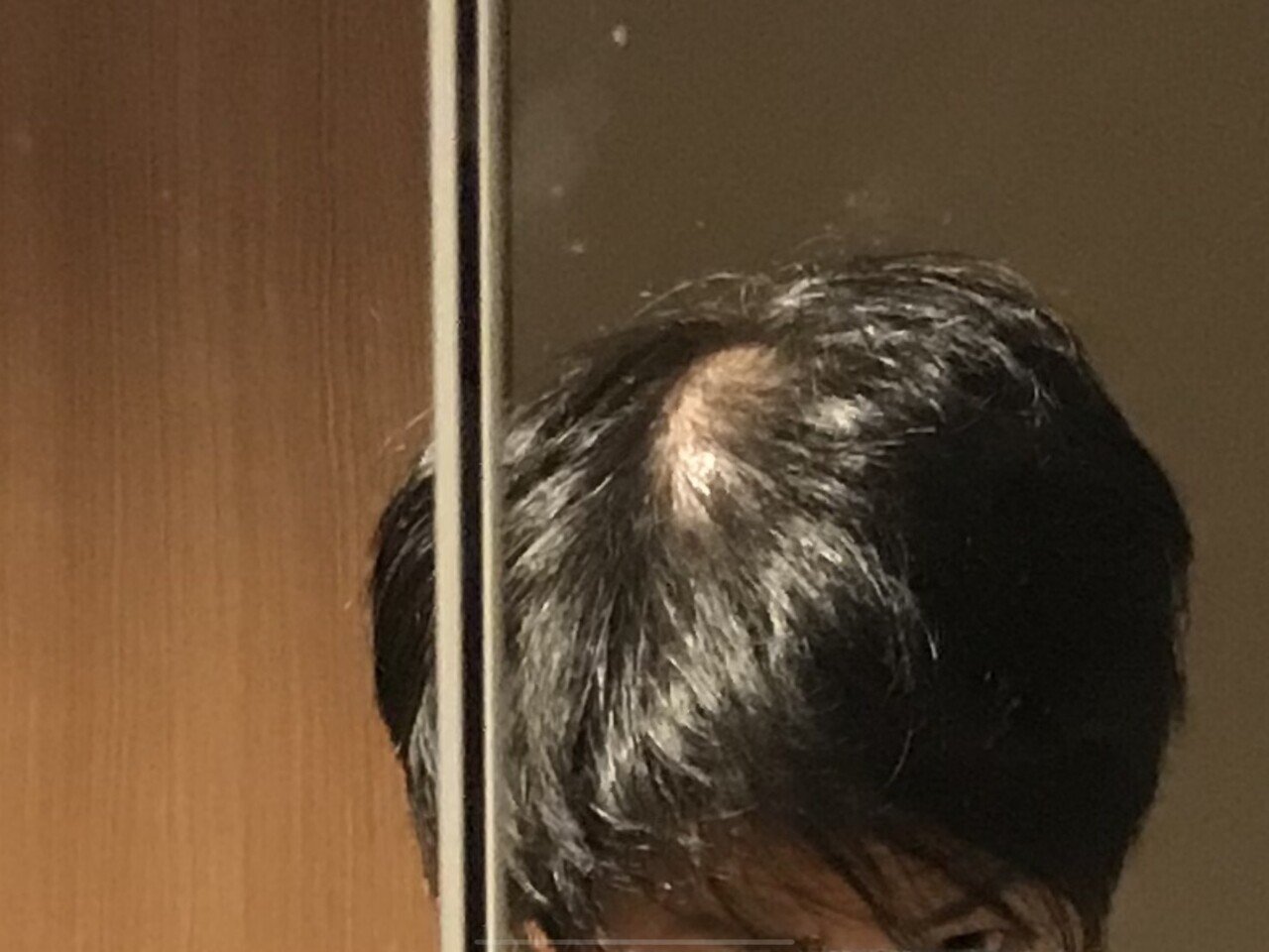 若ハゲ改善方法 これで絶対治る ブルズ Note