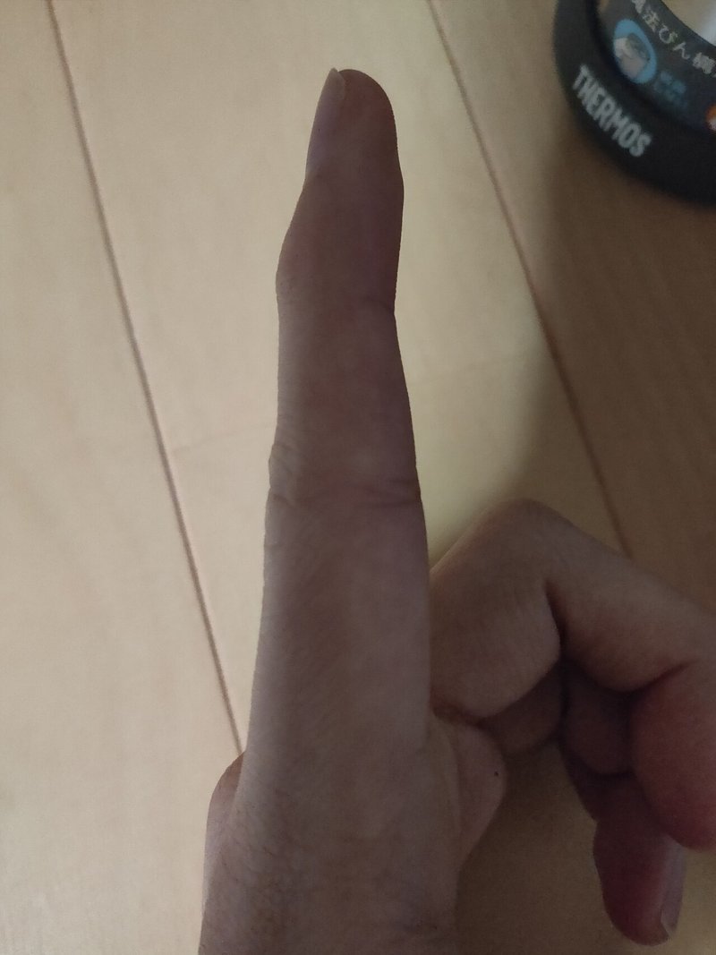 第一関節がずっと曲がっている話 昆布いおり Note