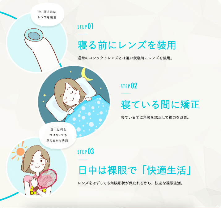 体験談 視力矯正手術 Icl を受けました てぃーーが Note 体験談 視力矯正手術 Icl を受けました てぃーーが Note