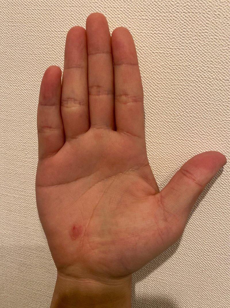 コラム記事 男らしさ は指の長さでわかる みーたく 不妊とわかった僕が今 伝えたい本当の不妊治療 Note コラム記事 男らしさ は指の長さでわかる みーたく 不妊とわかった僕が今 伝えたい本当の不妊治療 Note