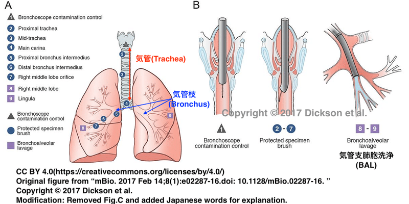 肺の模式図