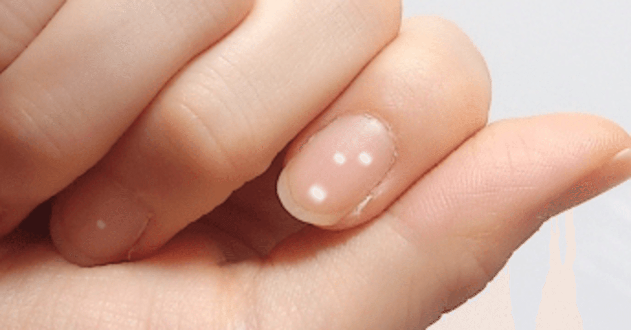 爪に白い斑点ができた|名無しのアルケミスト←フォロバ100|note