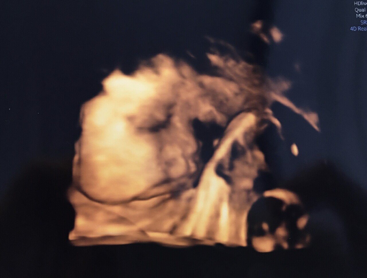 昨日の妊婦健診にて。臨月に入り、初めてわが子の顔を拝むことができ