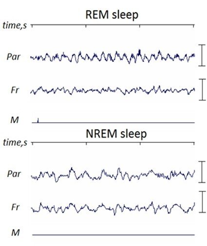 睡眠中の脳波