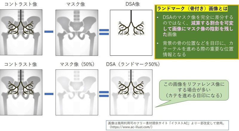 100円記事 カテ室に行く前に知っておきたかった無数のこと 後編 ペッサリー山田 診療放射線技師 Note