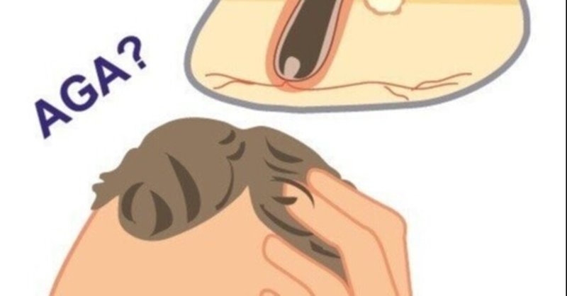つむじハゲ の新着タグ記事一覧 Note つくる つながる とどける つむじハゲ の新着タグ記事一覧 Note つくる つながる とどける