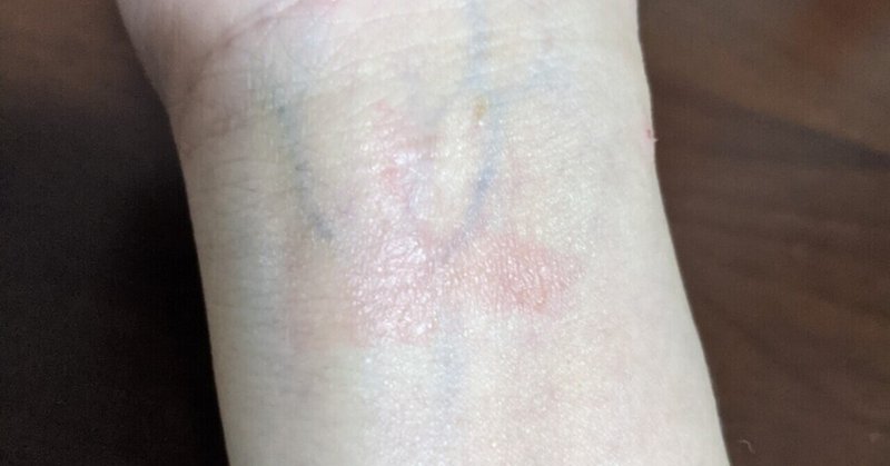 皮膚真菌症 の新着タグ記事一覧 note つくる つながる とどける