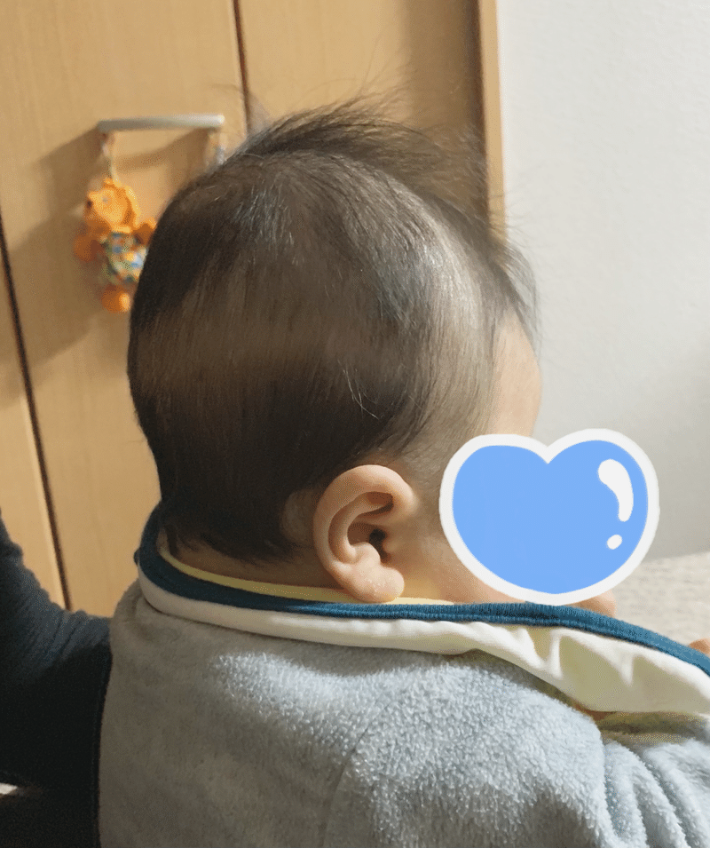 息子の絶壁頭を治すまでの日記 ゆま Note