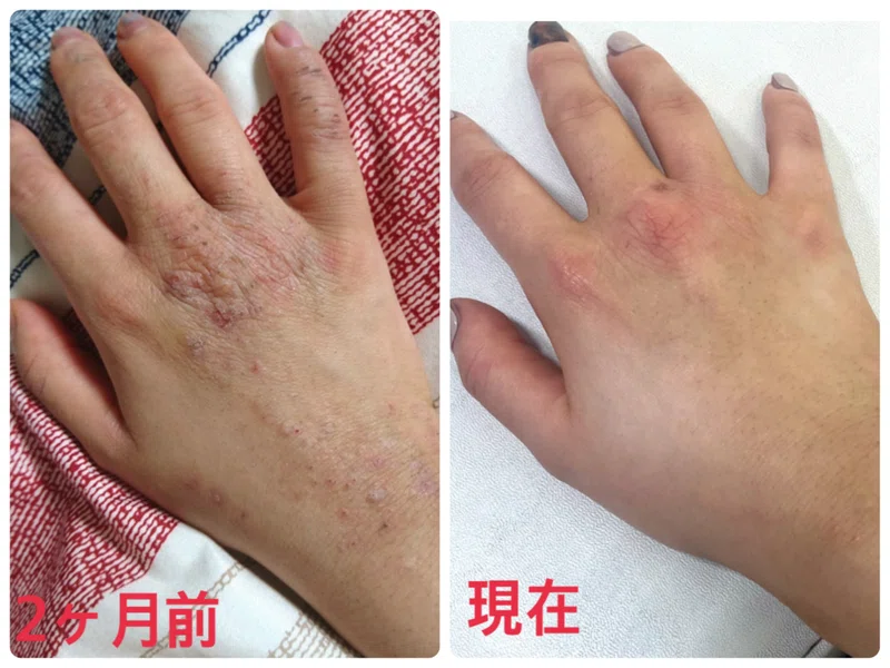 85 が手荒れの改善を実感 美容室で販売数日本一 美容師の手荒れを治すために作られたハンドクリーム ナノアミノ 個室型美容室gulgul Note