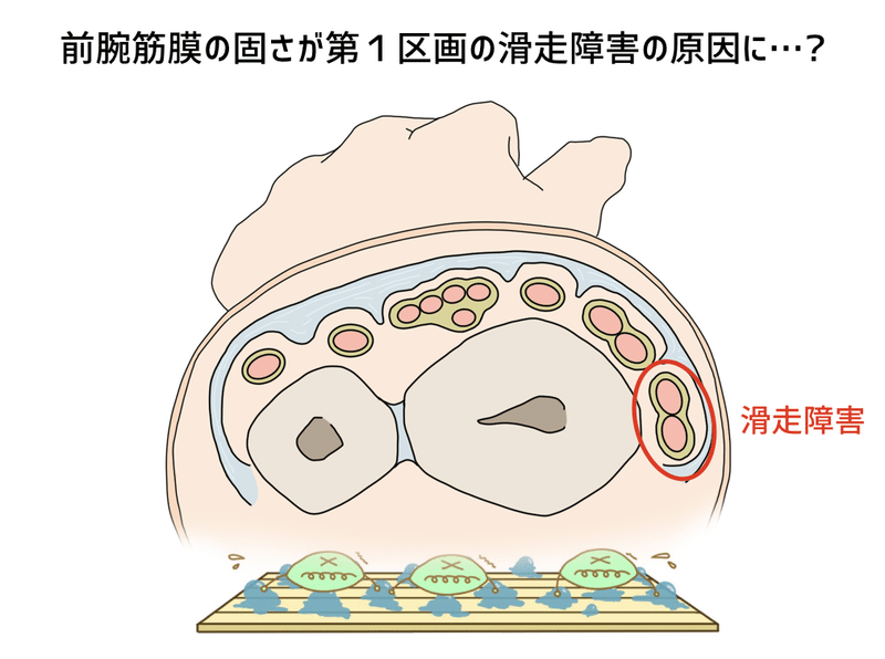 滑走