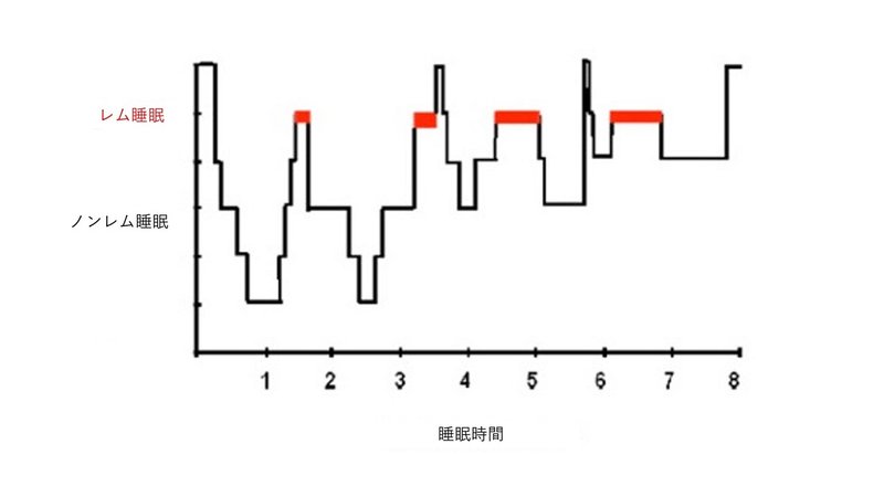 レム睡眠行動障害について やまおかみき Note