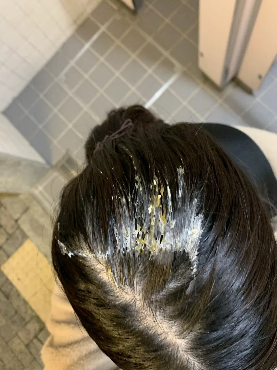 鳥 の フン 頭 に 落ち た