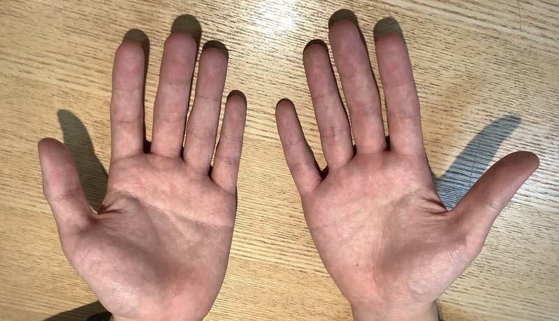 手相を見てもらいました 両手ますかけ シリー先生 Note