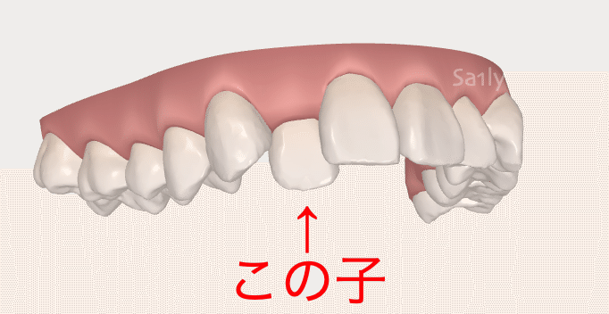 前歯