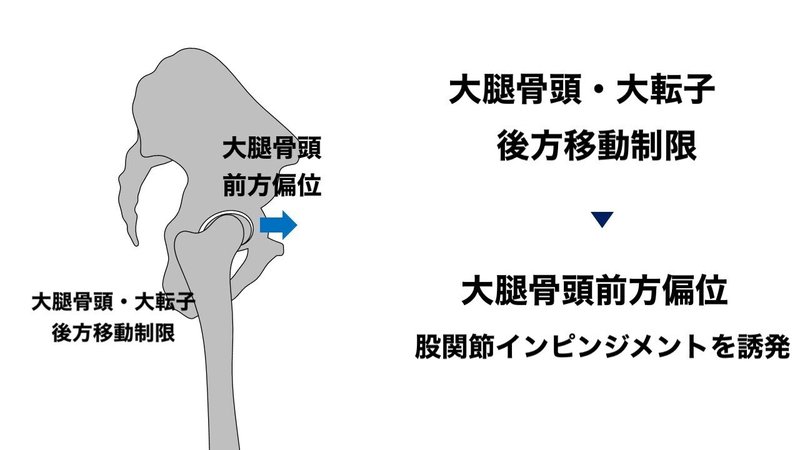 股関節インピンジメント 評価 L Fit Note