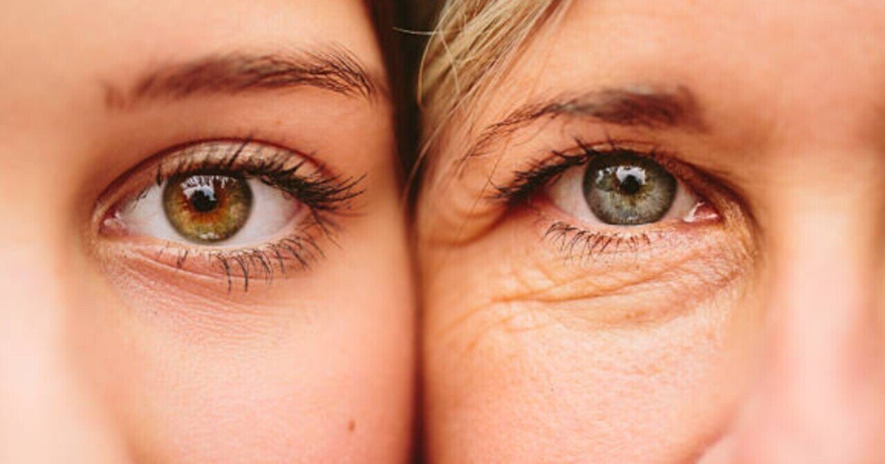 目の下のしわにボトックス注射をしたら！？どんな効果があるの？｜目の下のしわは美容整形とアイクリームどっちがいいの？, image size:1280x671