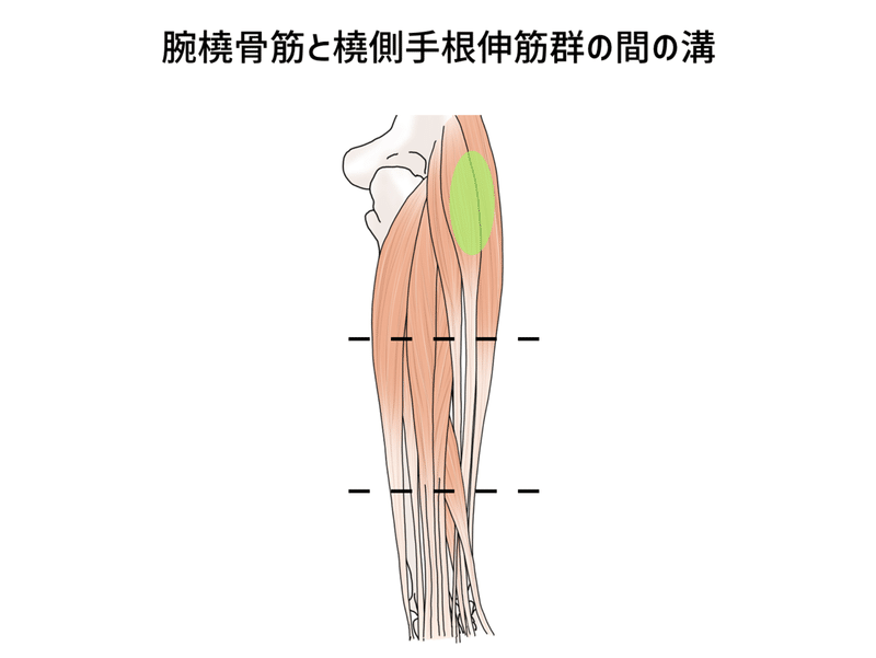 外側２