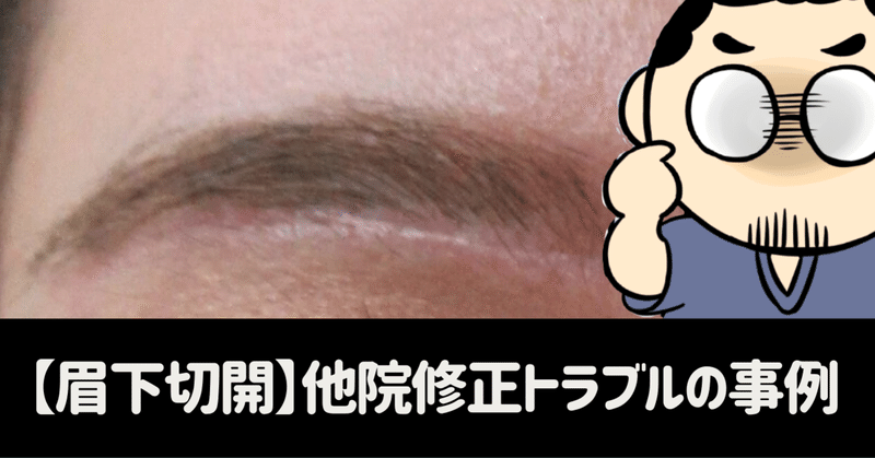 眉下切開 他院修正トラブルの事例 監修 眉下切開 瞼のたるみ豆知識 まぶたのお悩み解体新書 Note