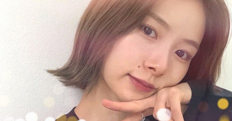 朝日奈央ほくろとったら可愛い 除去理由や病院費用も紹介 治療法とビフォーアフター画像も 愛美 Note 朝日奈央ほくろとったら可愛い 除去理由や病院費用も紹介 治療法とビフォーアフター画像も 愛美 Note