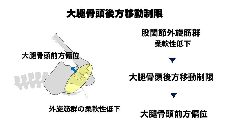 股関節インピンジメント 可動域改善 L Fit Note