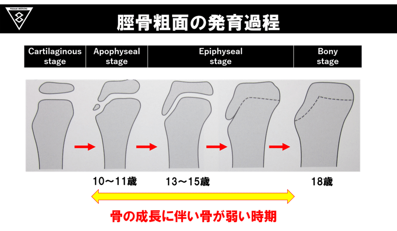 脛骨粗面の発育過程