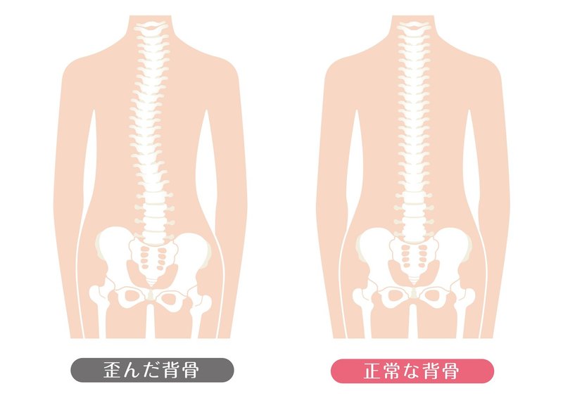 背骨の歪み　脊柱から骨盤