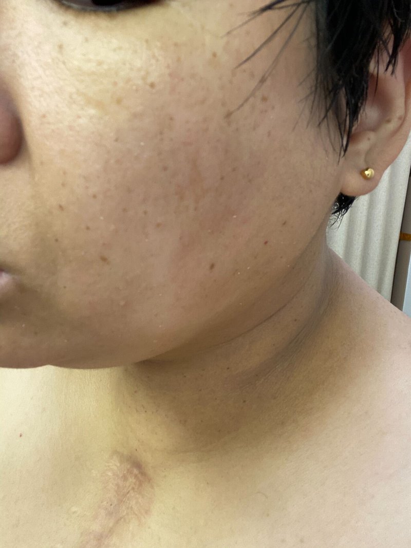 Ashadaは一ヶ月ではシミは消えない 宮 Note Ashadaは一ヶ月ではシミは消えない 宮 Note
