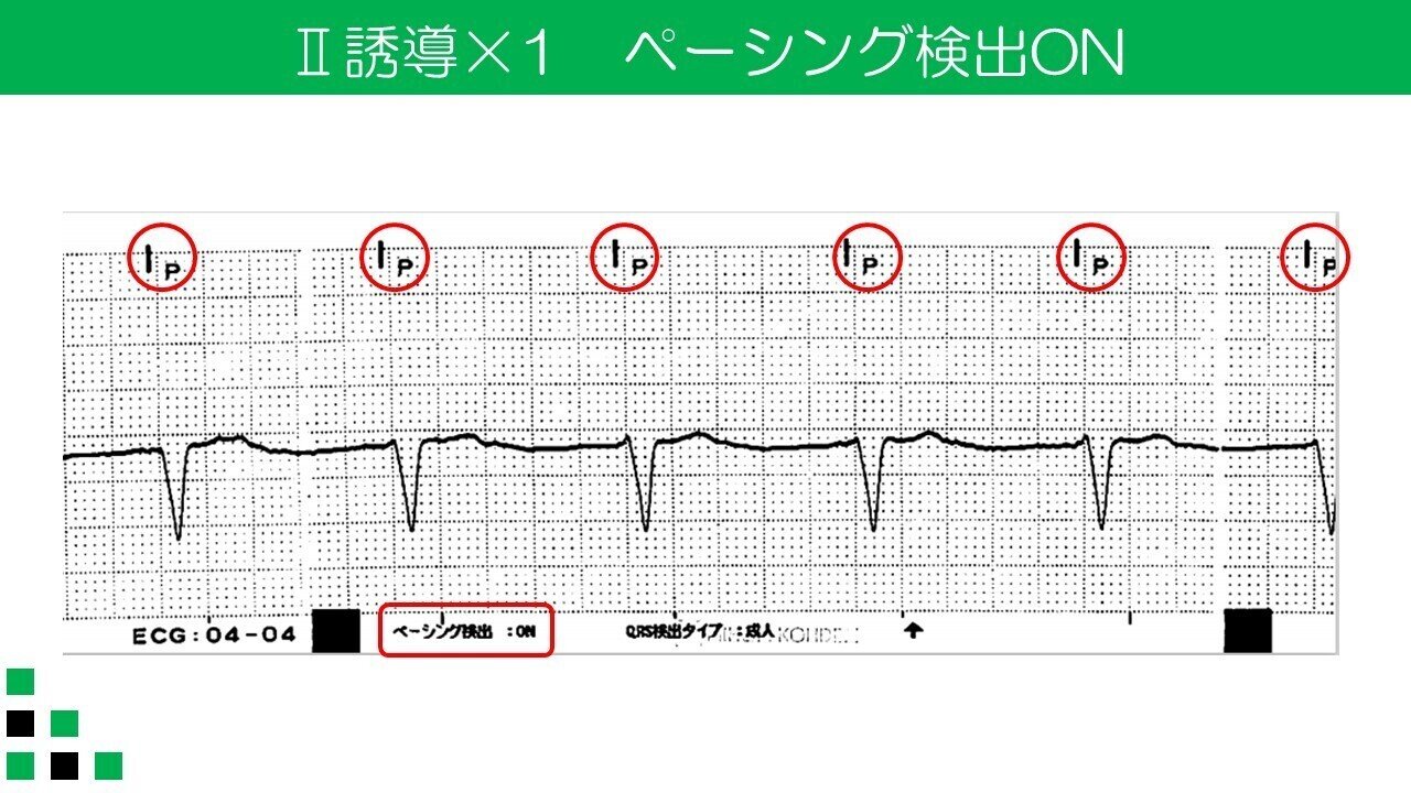 モニターを過信するな！？ その①｜ゆるひも@CE