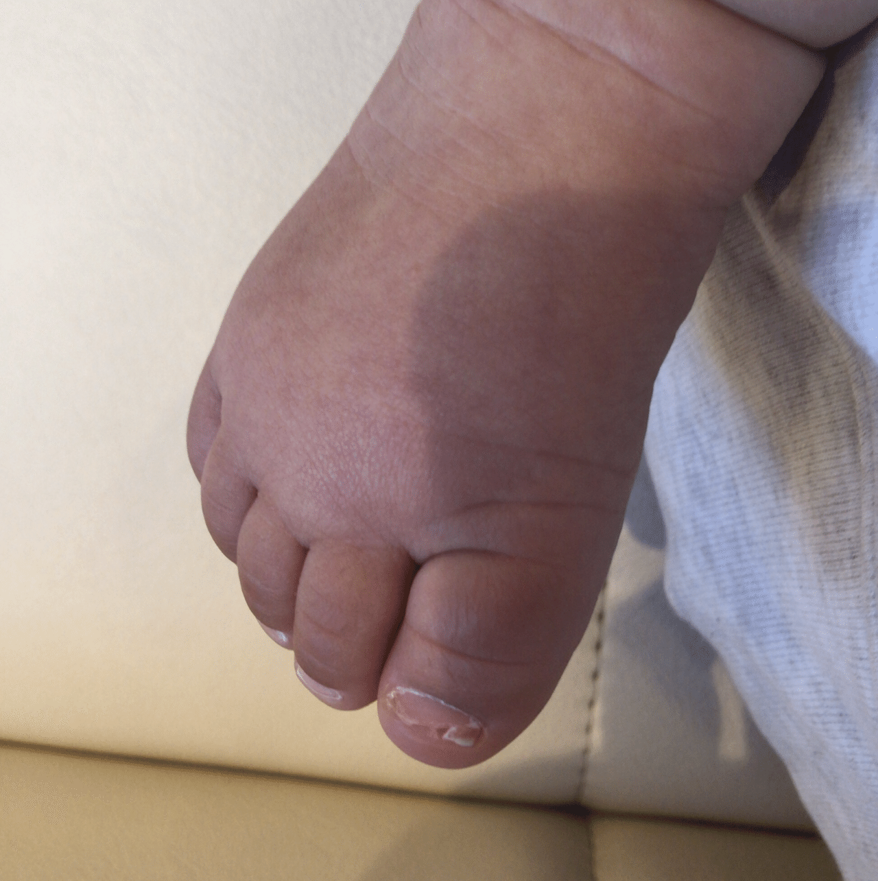 Vs 赤ちゃんの爪 星干 ひとで Note Vs 赤ちゃんの爪 星干 ひとで Note