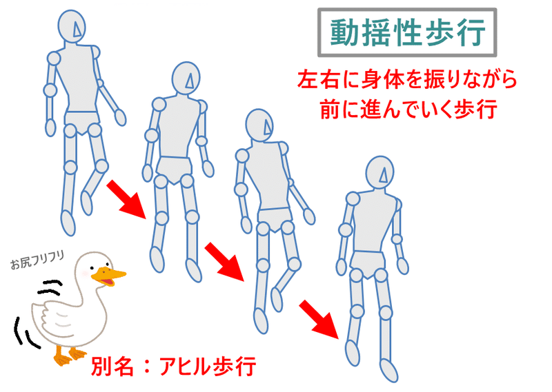 Pt Ot国家試験 明日の本番に向けて問題を出すよ 神経筋疾患 ダイ吉 教員 理学療法士 Note