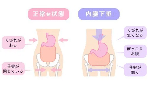 女性の下っ腹ぽっこり対策 いむ先生 No1 ストアカ講師 Note