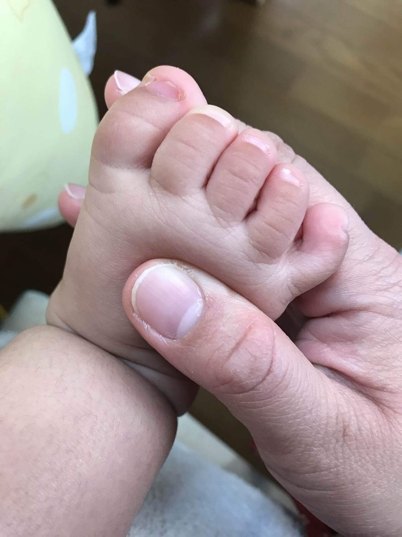 Vs 赤ちゃんの爪 星干 ひとで Note