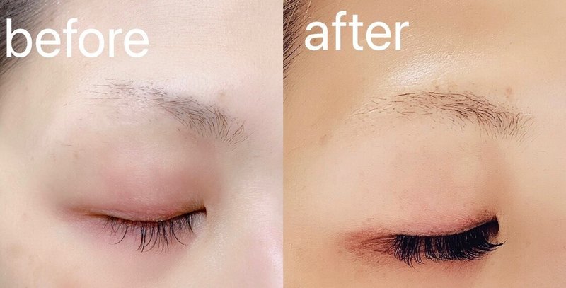 まゆげが生えてこない と嘆いている方へ 眉ナシさんの救世主美容液あります Rita 美容商材セレクトショップ Note まゆげが生えてこない と嘆いている方へ 眉ナシさんの救世主美容液あります Rita 美容商材セレクトショップ Note