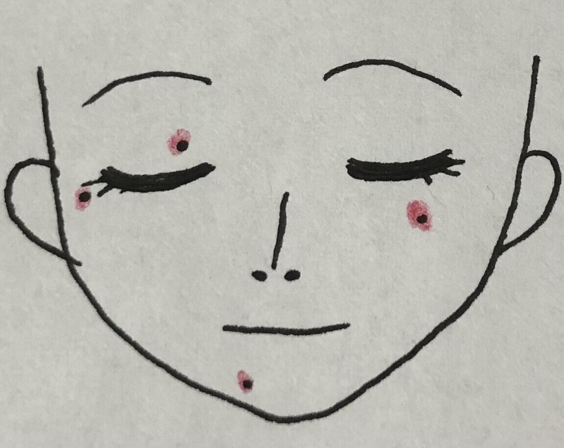 顔のほくろが意味するのは Ksm Note 顔のほくろが意味するのは Ksm Note