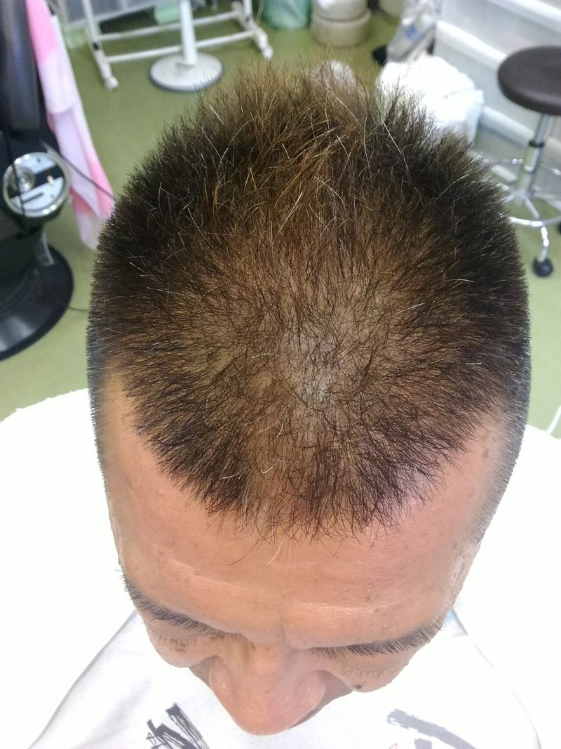 白髪を抜き続けて10年以上経って 日本一の白髪抜き店 Barberdon Note 白髪を抜き続けて10年以上経って 日本一の白髪抜き店 Barberdon Note