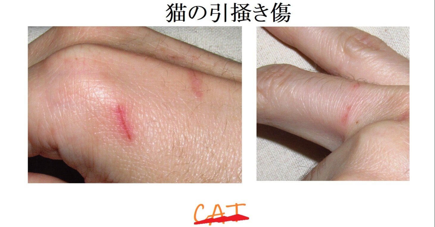 刺されたり噛まれたり立てられたりの話 駄弁駄文渓谷世迷之滝 Dabenstein Note 刺されたり噛まれたり立てられたりの話 駄弁駄文渓谷世迷之滝 Dabenstein Note