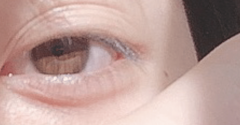 潰された私の体躯は酷く脆い固形と化して 1nakq Note