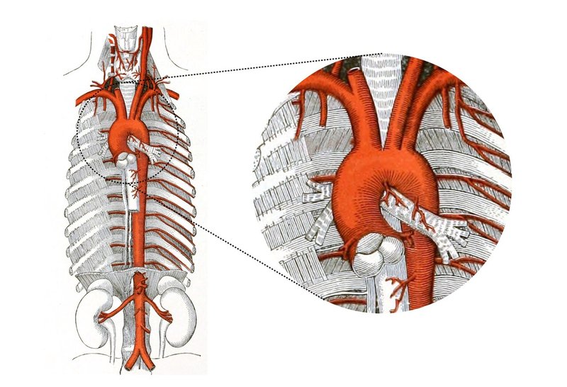 呼吸器系-32-気管・気管支と大動脈の位置関係-SQ-図