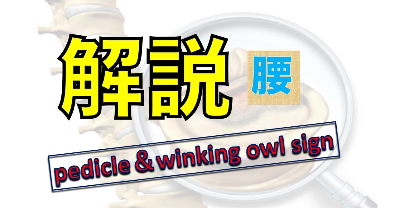 Pedicle Sign pedicle&winking owl signを紐解く|Oka/鍼灸理学トレーナー