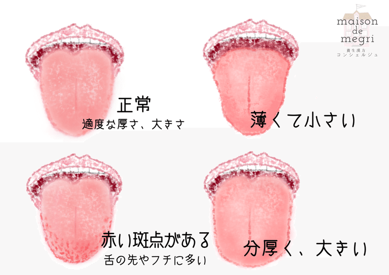 舌の先が赤くてトゲトゲでちょっと痛い ワタシスキャン 035 Maison De Megri のnote 養生漢方コンシェルジュ Note