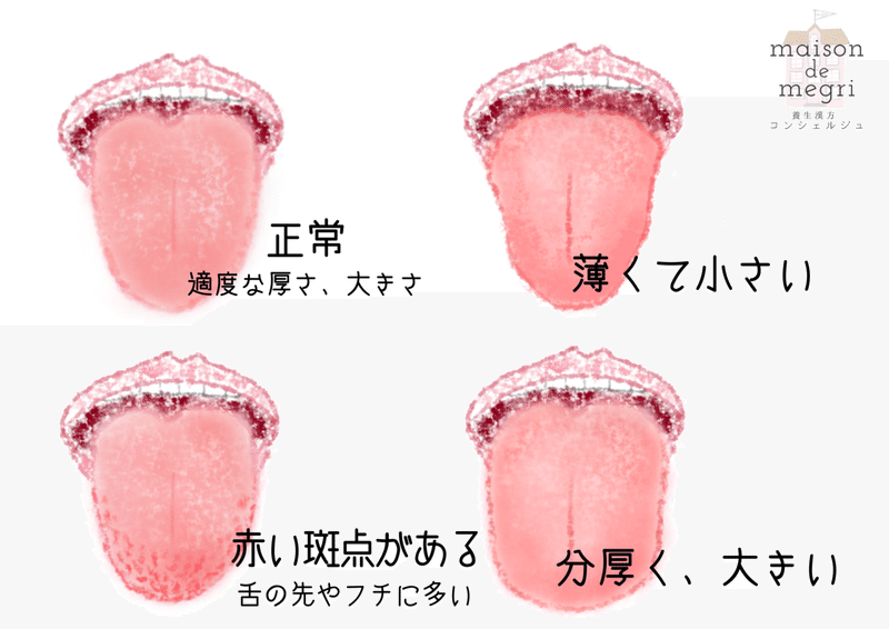 舌の先が赤くてトゲトゲでちょっと痛い ワタシスキャン 035 Maison De Megri 養生漢方コンシェルジュ Note