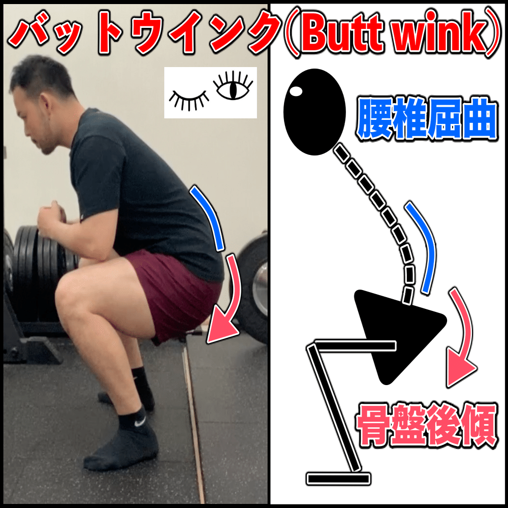 スクワット バットウインクと腰椎ヘルニア フォームの観点から徹底解説 ノリ トレーニングラボ Note