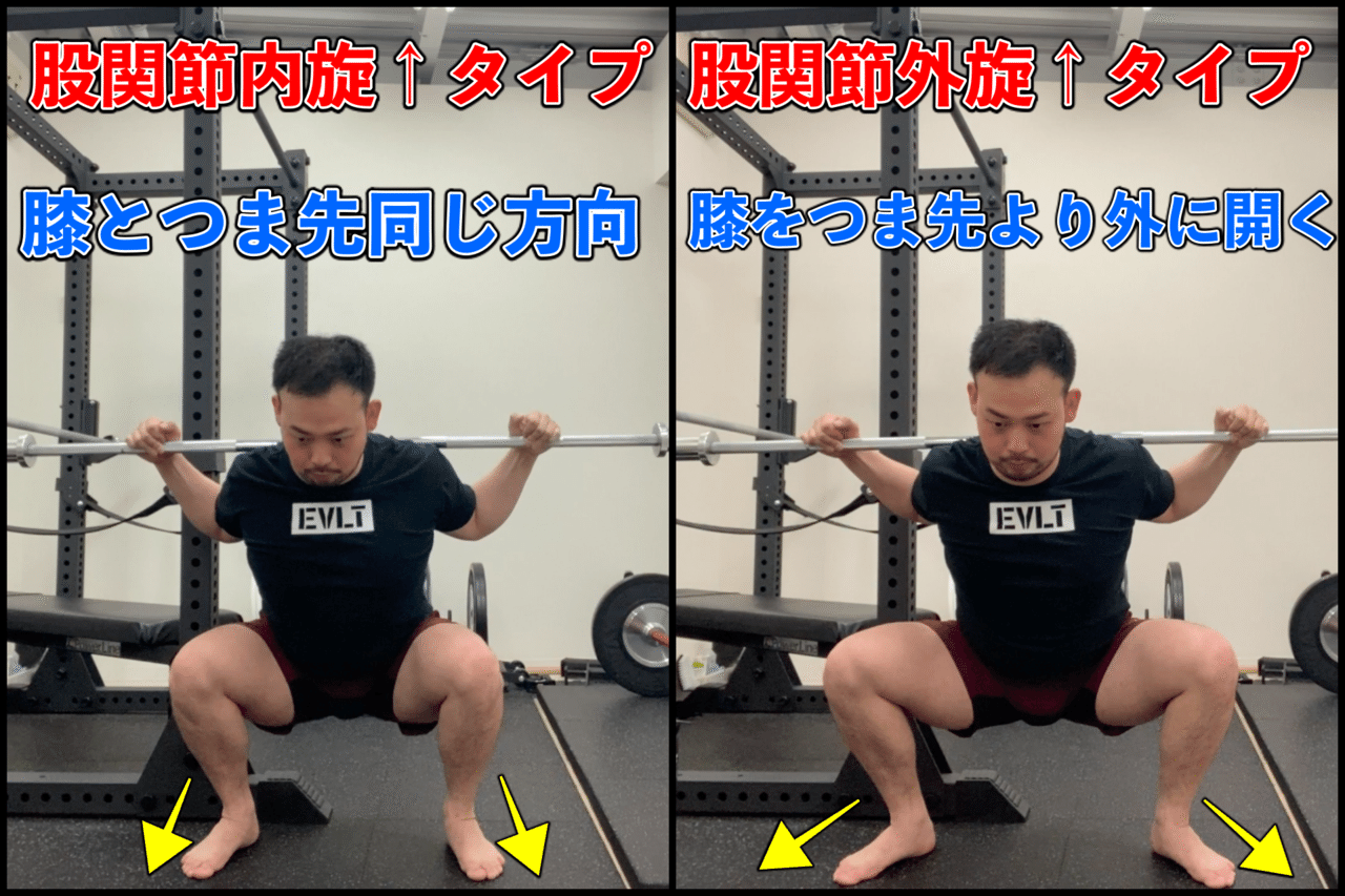 スクワット バットウインクと腰椎ヘルニア フォームの観点から徹底解説 ノリ トレーニングラボ Note スクワット バットウインクと腰椎ヘルニア フォームの観点から徹底解説 ノリ トレーニングラボ Note