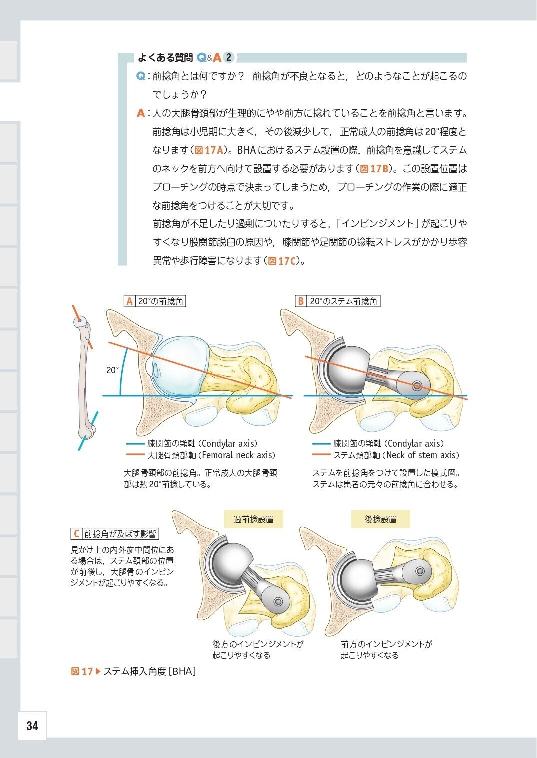 基本的な解剖や手術のピットフォールをしっかり頭にインプットし 基本的な解剖や手術のピットフォールをしっかり頭にインプットし