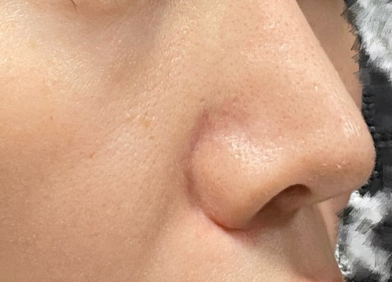 毛穴の中が黒くみえない 開きが目立たない をゴールに提案しました つば エクストラクションの人 Note 毛穴の中が黒くみえない 開きが目立たない をゴールに提案しました つば エクストラクションの人 Note
