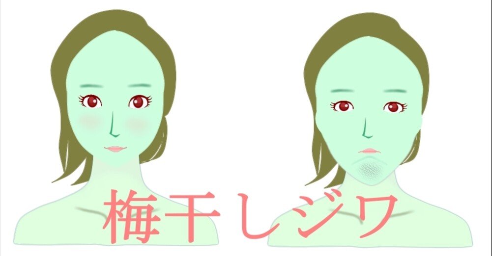 顎先の梅干しシワを無くす方法 お顔の整体師 戸塚哲春 Note